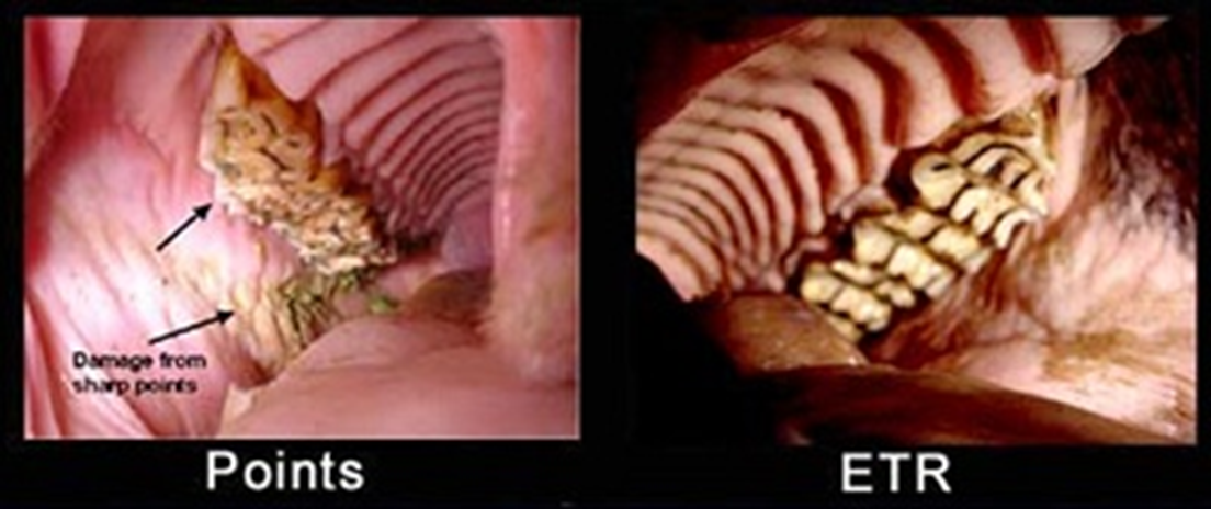 Excessive Transverse Ridges ETR